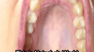 Roof Of Her Mouth