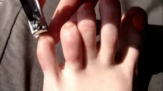 Too Long Toe Nails Cut Down