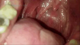 Deep inside my mouth