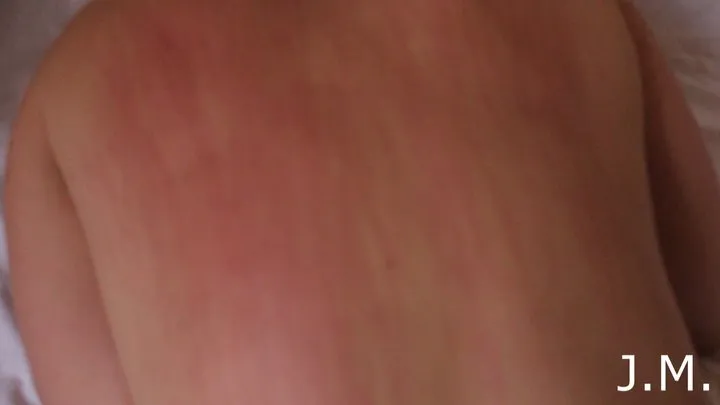 marks on the skin