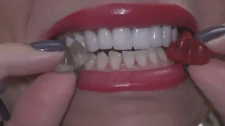 sharp teeth-special clip