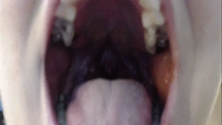 Close-up of mouth, teeth, tongue, throat