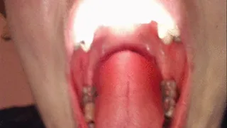 Uvula Gagging II