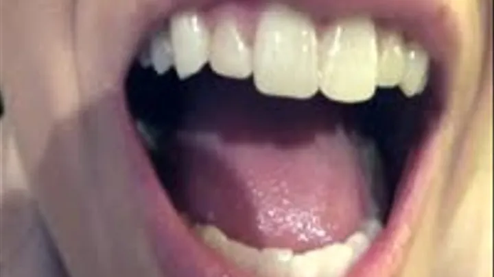 Extreme close-ups of Danielle Trixie TEETH!