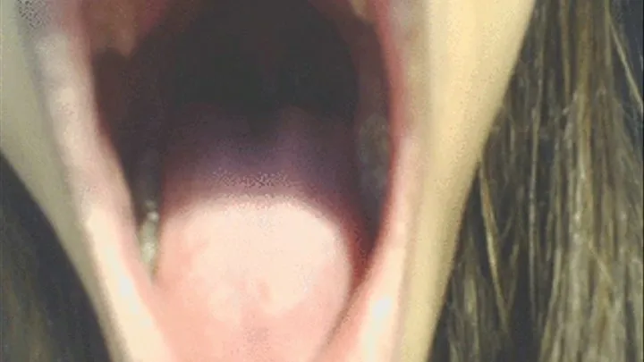 Inside The Roof of my mouth