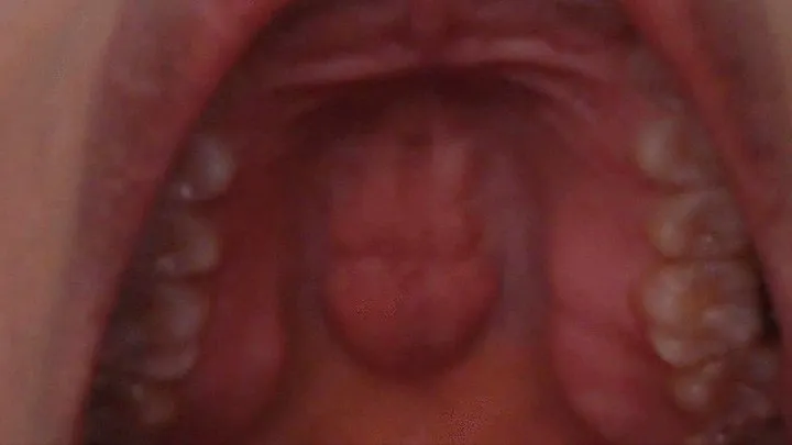 Inside My Mouth