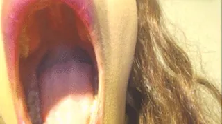 Open Wide Part 2