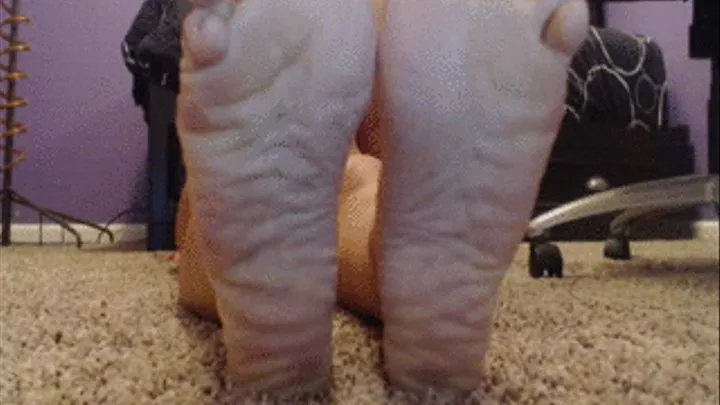 Extreme foot wrinkling