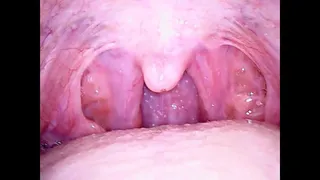 Gorgeous Mouth Inspection With Phoenix Wild