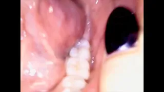 Mouth Inspection With Velma Von M & Goddess Valora