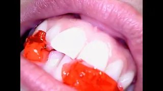 Mouth Inspection & Gummy Bears With Gia Love