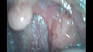 Endoscope Mouth Inspection With Dustin Steele & Toby Springs