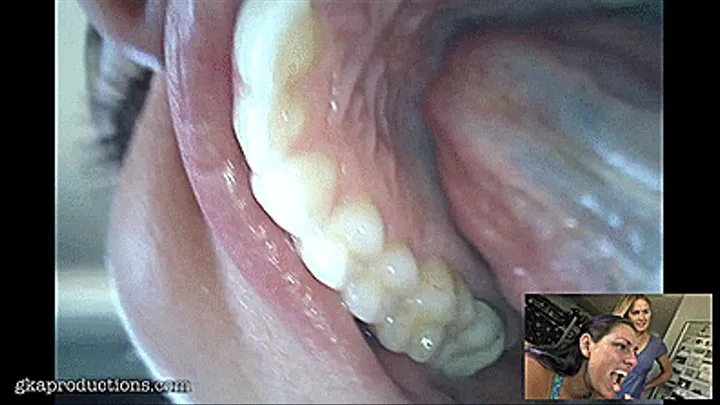 Endoscope Mouth Tour With Vanessa Rain & Vika