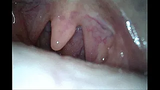 Endoscope Mouth Tour With Sadie Holmes