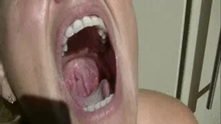 Sunshine Throat and Uvula Close Up (WMV)