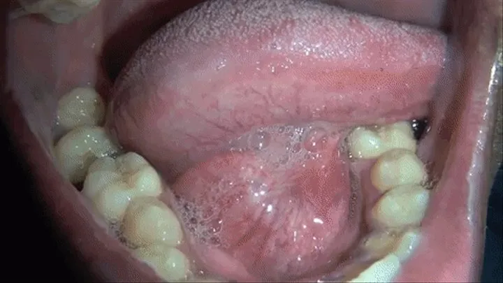 Aaron's Big Mouth & Tongue