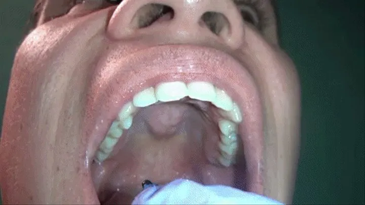 Evil Dentist Shrinks & Swallows Patient