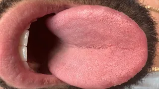 Shane's Big Mouth & Tongue