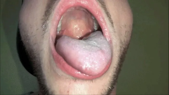 Ian's Big Mouth & Tongue- MKV