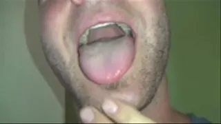 Cody's Big Mouth & Tongue