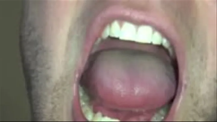 Cody's Big Mouth & Tongue- MKV