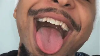 Patrick's Big Mouth, Tongue & Hiccups