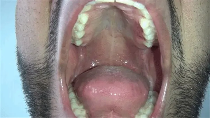 Ari's Big Mouth & Tongue