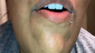 Sick tonsil exploration with coughing flem