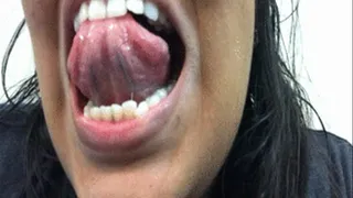 Up close tongue 1.6.18