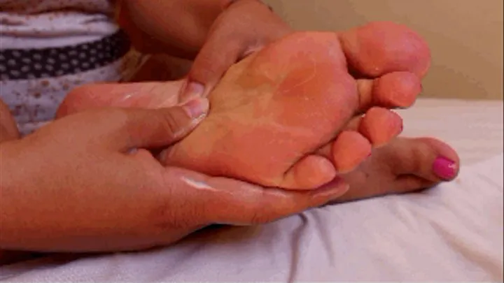 Dry soles creamy treatment