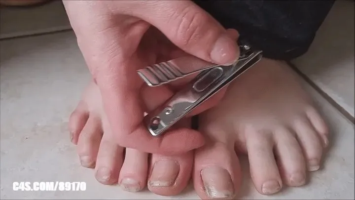 Clipping Nasty Toe Nails