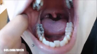 Will You Look Inside My Mouth?