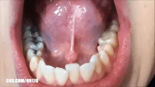 Lingual Frenulum Fetish