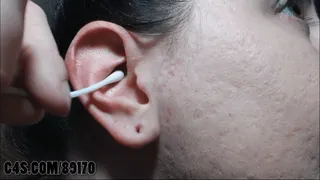 Deep Ear Wax Cleaning