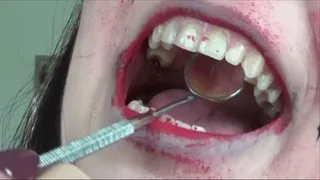 Mouth infection!