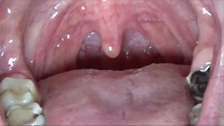 My uvula!