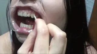 Leftover food on teeth