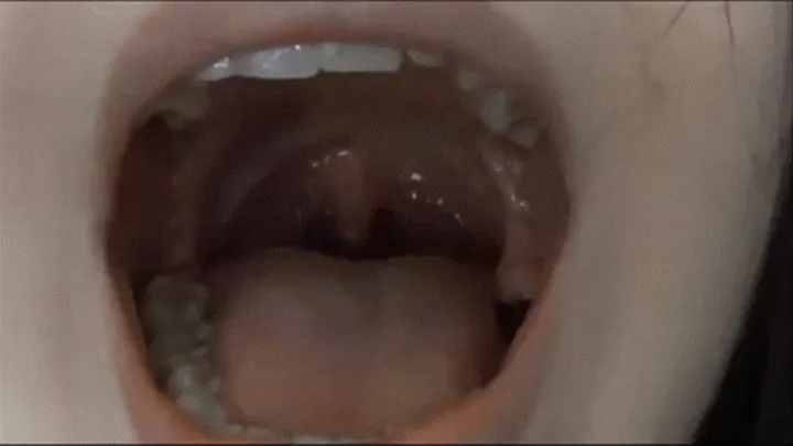 Huge uvula! Full open throat