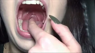 My perfect uvula