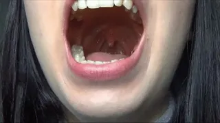 Uvula in close up