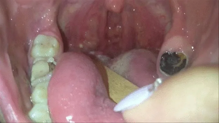 Inside my mouth with cam