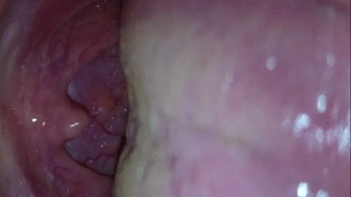 uvula