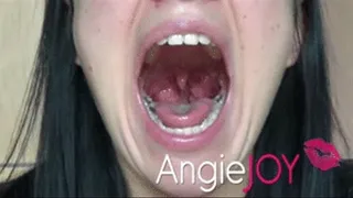 Squeezing tonsils!