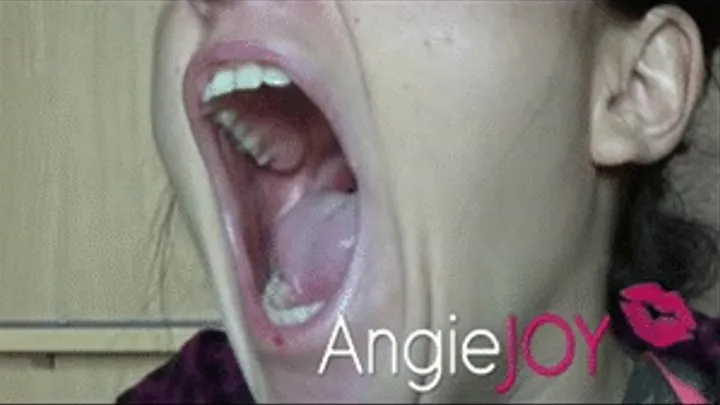 Dental yawning