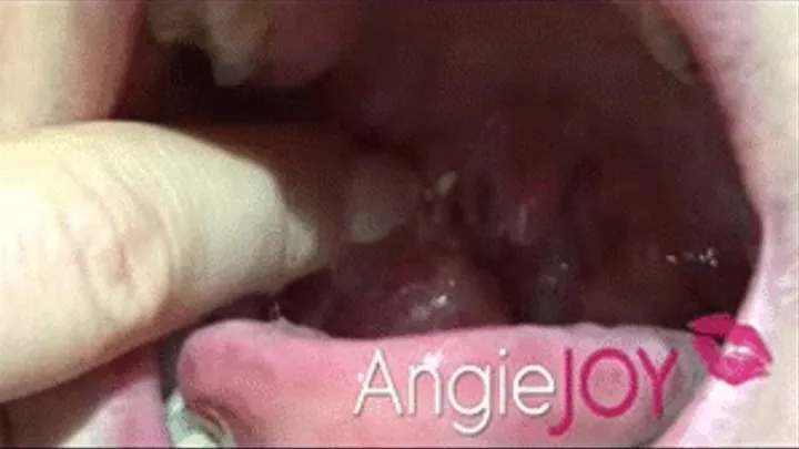 squeezing phlegm from tonsil