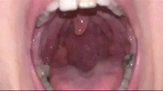 Cleaning the tonsils