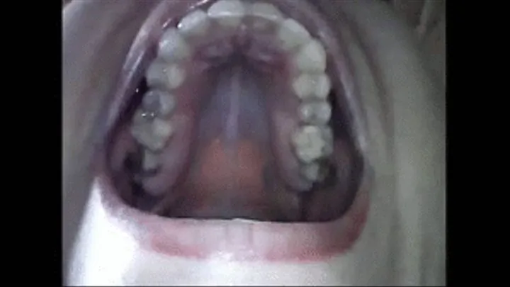 Endoscopic yawning