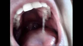 Endoscopy yawning