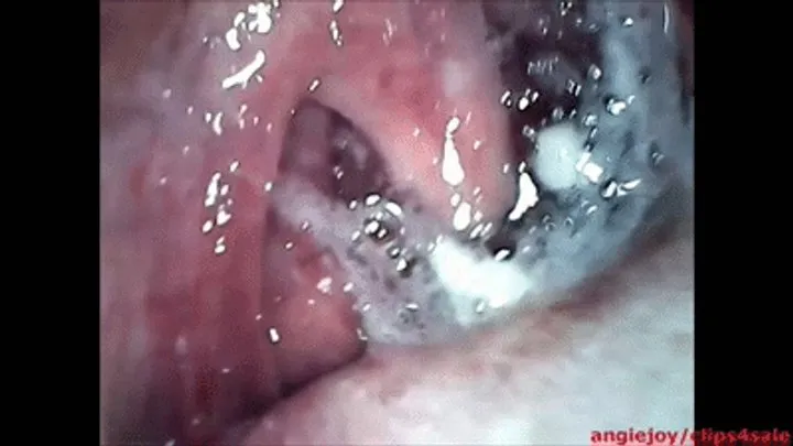 Phlegm eruption in the throat