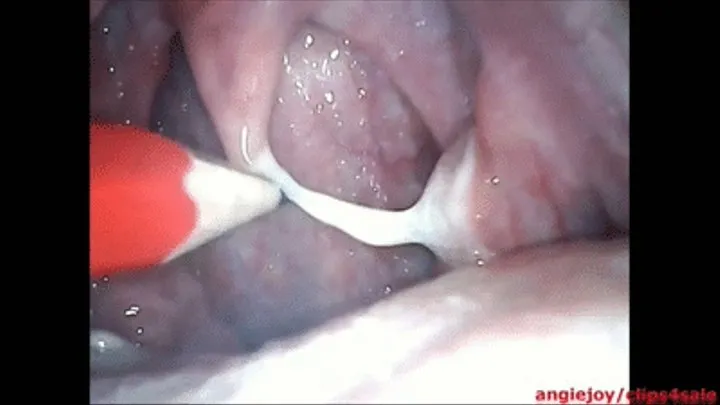 Phlegm eruption in the throat